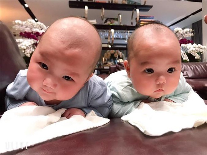 Hai em bé song sinh nhà siêu mẫu Trương Nam Thành